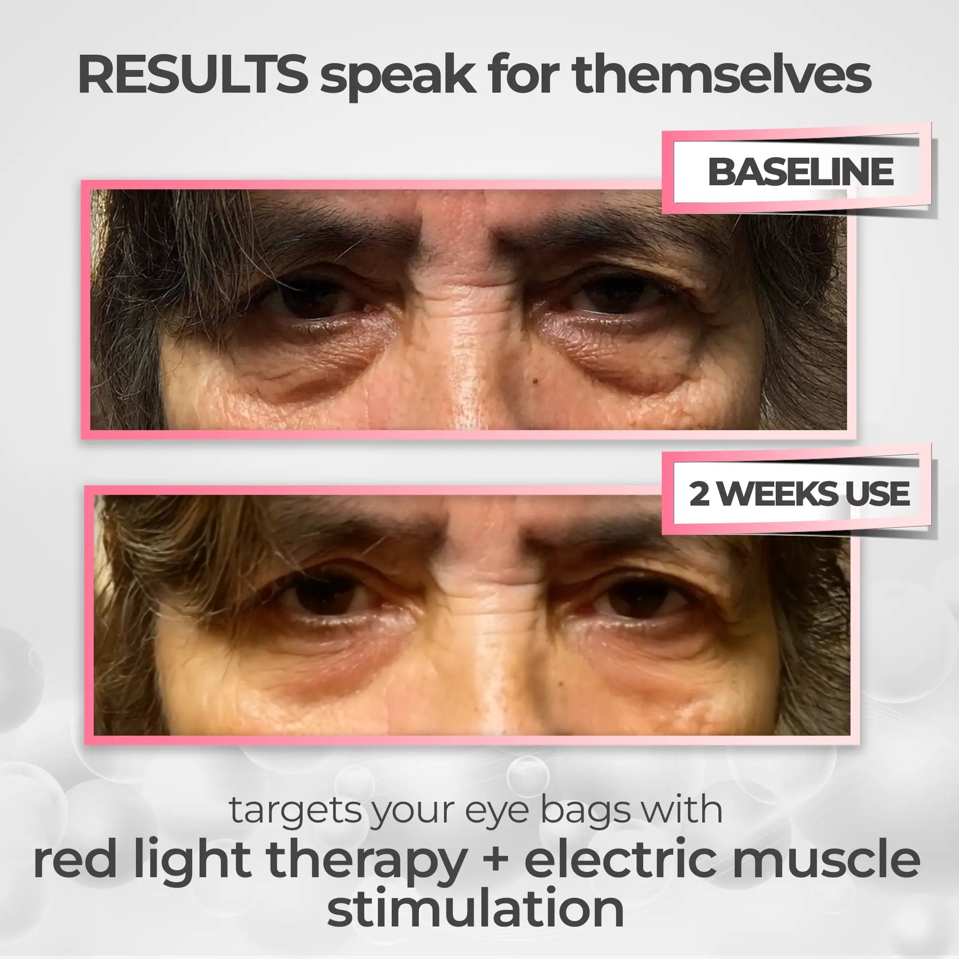 2-in-1 Red Light Therapy