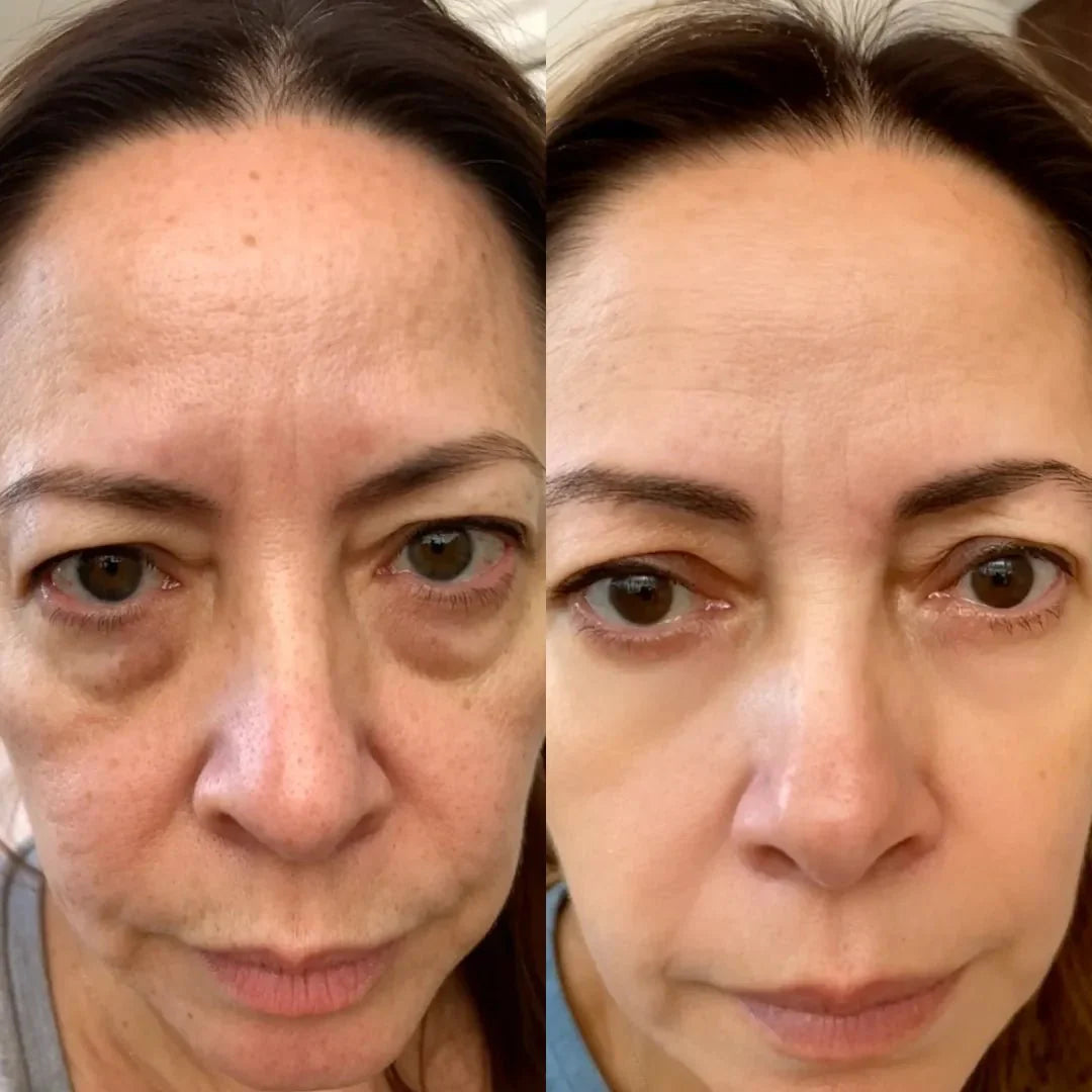 2-in-1 Red Light Therapy